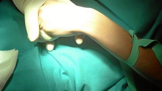 La rueda del paciente