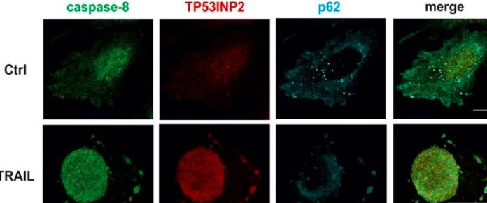 Identifican un nuevo biomarcador para realizar tratamientos personalizados contra el cáncer