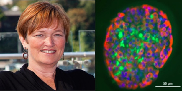 Logran neutralizar en modelos animales la acumulación de partículas tóxicas responsable del desarrollo del Alzheimer